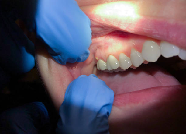 Best Emergency Treatment for Jaw Pain or Injury in Shawnee, KS